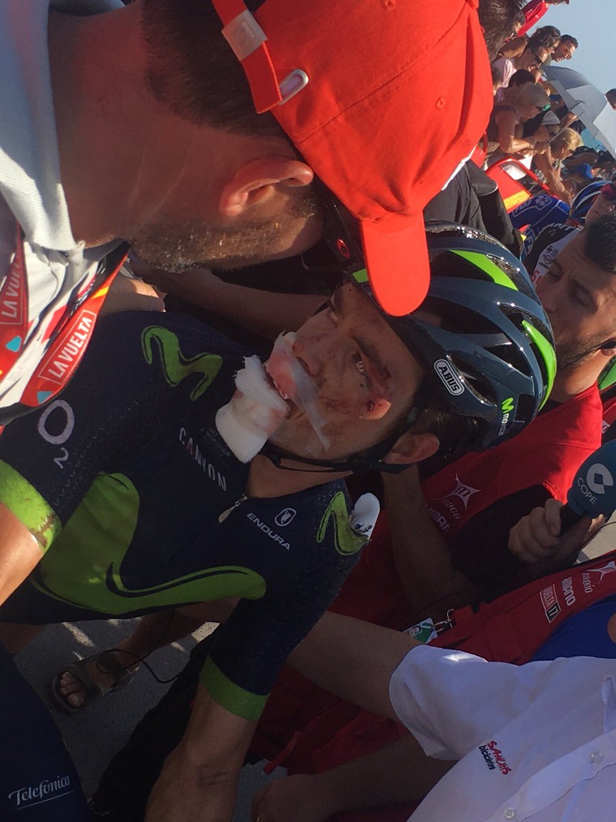 Betancur pedalou 37km com tornozelo quebrado!